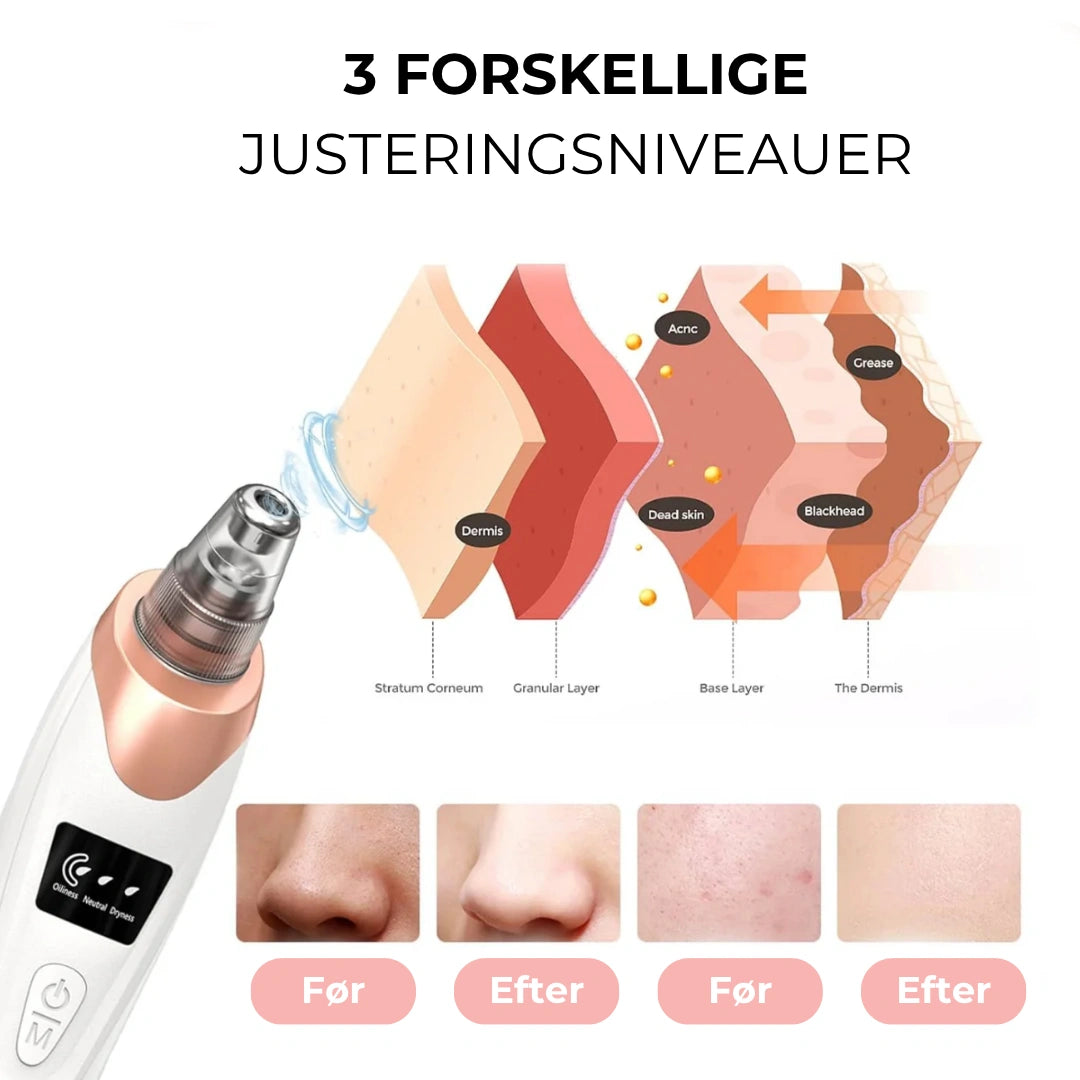 PureGlow - Hudormefjerner med vakuumteknologi